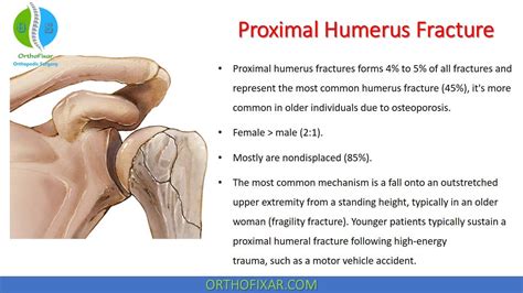 axial compression test humerus fracture|proximal humerus fracture differential.